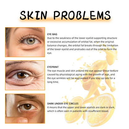 Vitamin C Remove Dark Circles Eye Serum Anti-Wrinkle Fade Fine Line Anti Eye Bag Puffiness Essence Anti-Aging Lift Firm Eye Care